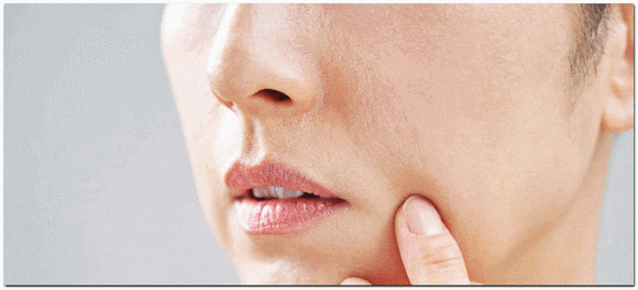 레스틸렌 비탈라이트 춥고 건조해서 얼굴이 당긴다면? 관련 이미지 2