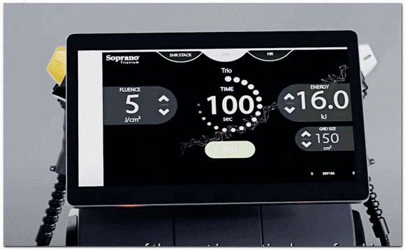 울타늄(울쎄라+티타늄) 효과, 왜 굳이 두 가지나 받을까? 관련 이미지 8