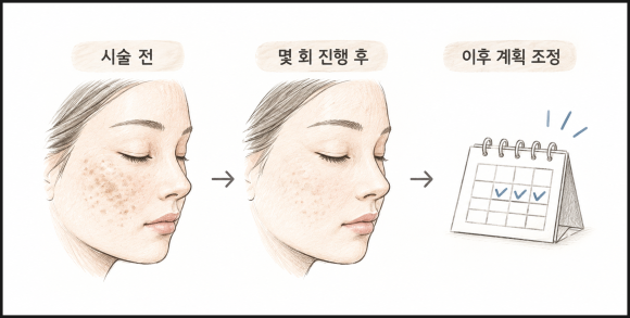 영등포역피부과의원, 레이저토닝 횟수와 변화 시점은? 관련 이미지 3