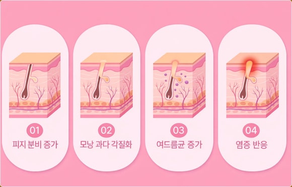 영등포피부과추천 후기 찾는 분들이 놓치기 쉬운 기준 관련 이미지 2