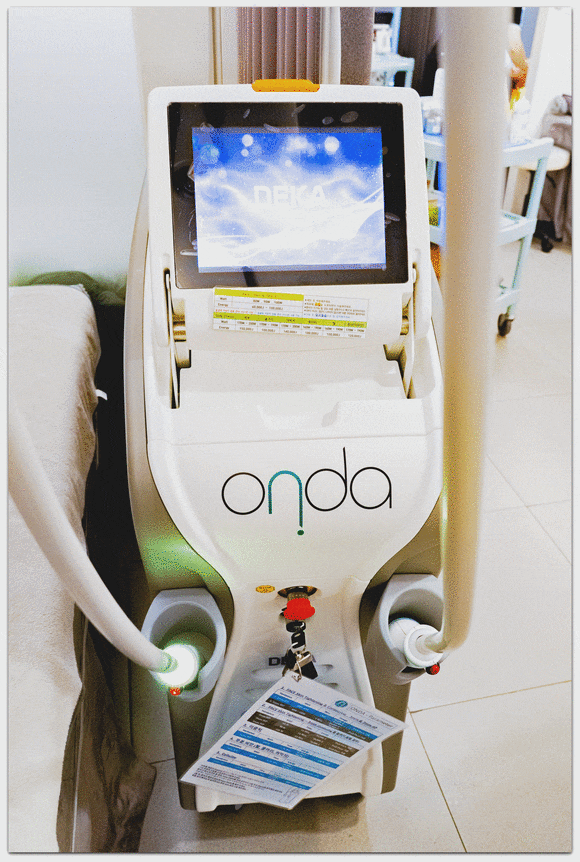 온다리프팅 6만줄 실제 효과, 통증, 부작용은 어떨까? 관련 이미지 2