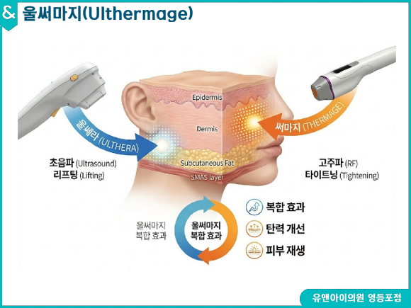 울쎄라피프라임 vs 써마지, 어떤 게 좋을까? 관련 이미지 4