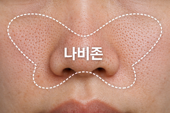 Pico Fractional on the Butterfly Zone: Curious About Its Effects and Side Effects? image 2