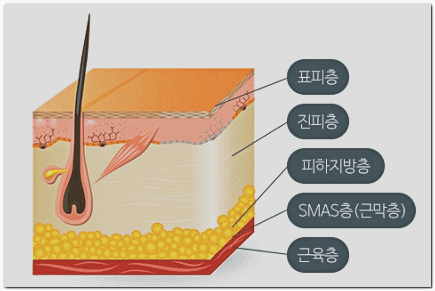 영등포 울쎄라 써마지 비교, 둘 중 뭐가 나을까? 관련 이미지 7