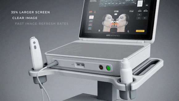 영등포울쎄라 탄력개선하려면 <샷수보다 중요한 이것> 관련 이미지 2