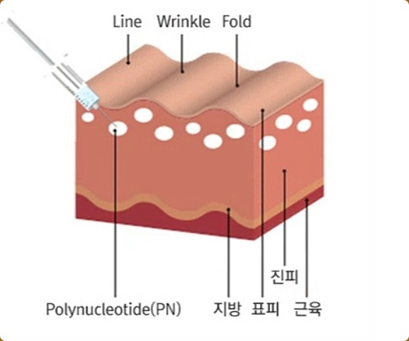 영등포 리쥬베룩 뜻 효과 후기 궁금하다면? 관련 이미지 2