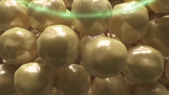 온다 티타늄 같이 받았을 때 효과는? 관련 이미지 2