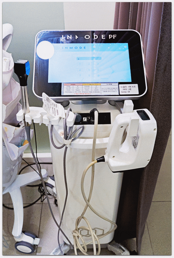 인모드 슈링크 주기, 어떻게 맞추면 좋을까? 관련 이미지 3