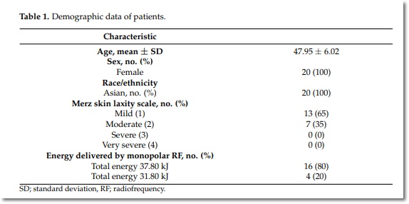 올리지오 유지기간 얼마나 오래가는지 궁금하다면? 관련 이미지 4