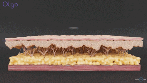 영등포구청역 피부과 진료, 올리지오 샷 수 가이드 관련 이미지 3