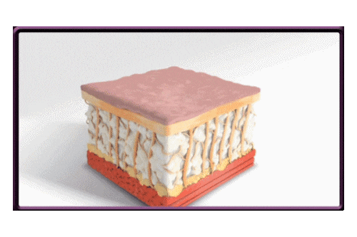 눈가 리프팅 종류, 탄력 잔주름에 효과 있는 것은? 관련 이미지 6