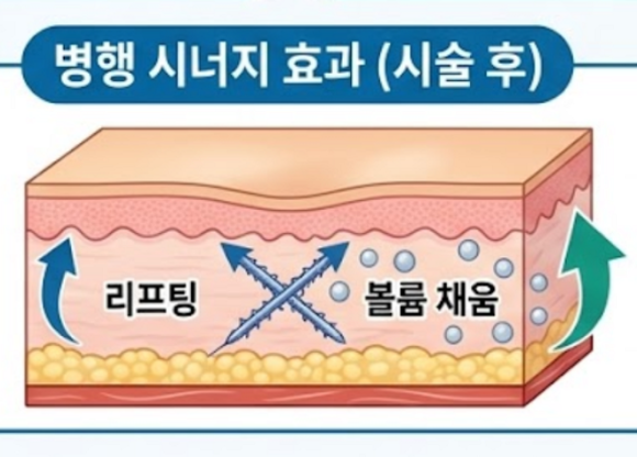 What Do You Think of the Combination of Jambersil and Juvelook for Nasolabial Folds? image 7