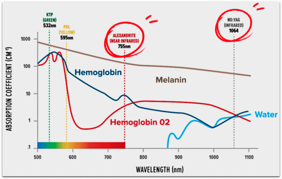 영등포제모, 왜 젠틀맥스 프로플러스 추천이 많을까? 관련 이미지 3