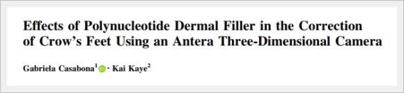 영등포리쥬란 눈가 주름 개선 효과는? 관련 이미지 1