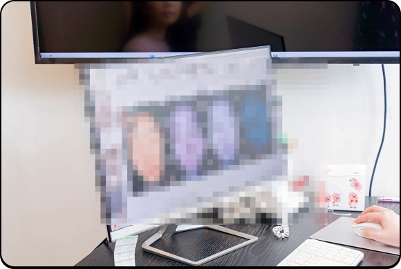 영등포 피부과 진료, 여드름 치료 어디로 갈지 고민이라면 관련 이미지 4