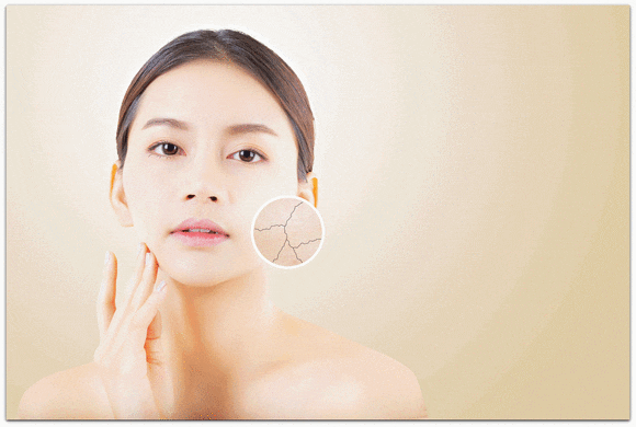 레스틸렌 비탈라이트 춥고 건조해서 얼굴이 당긴다면? 관련 이미지 3