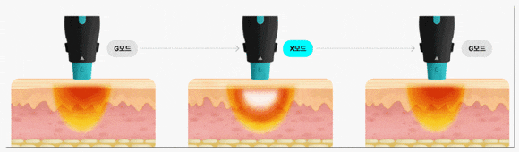 올리지오X 올리지오 개선사항 <300샷 효과> 관련 이미지 4