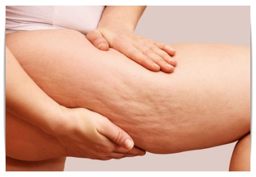 바디인모드 허벅지 군살 관리법 정리해드릴게요 관련 이미지 3