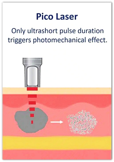 나비존 모공 프락셀, 통증 부작용에 대한 오해와 진실 관련 이미지 4