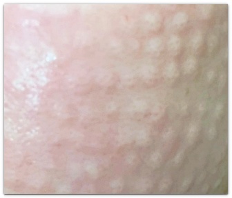 스킨바이브 리쥬란 효과 있다는 후기 진짜일까? 관련 이미지 5