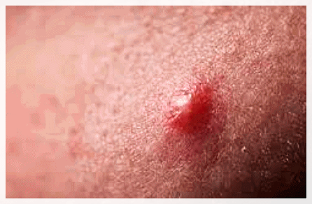 Recommended Dermatology Clinic in Mullae: Wondering Whether You Need Skincare or Treatment? image 4
