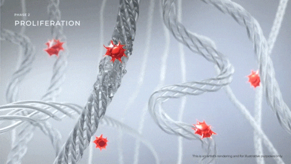 영등포울쎄라 탄력개선하려면 <샷수보다 중요한 이것> 관련 이미지 3