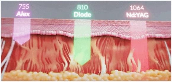 영등포피부과리프팅 통증 적고 효과도 좋은 리프팅이 필요하다면? 관련 이미지 4