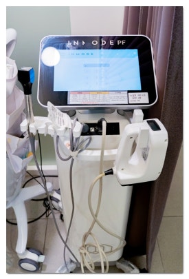 인모드 슈링크 효과 기간 비교해드립니다. 관련 이미지 1