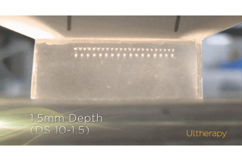 눈가 리프팅 레이저, 깊은 주름과 잔주름 모두 케어해야 한다면? 관련 이미지 4