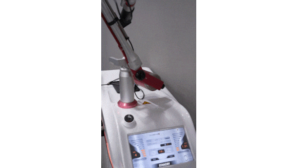 영등포잡티제거 시술, 1회 관리로 없어진다는 말 사실일까? 관련 이미지 6