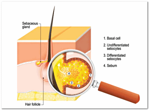 영등포여드름피부과 남자 여드름은 어떻게 치료해야 할까? 관련 이미지 3