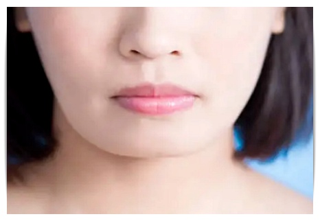 영등포역보톡스 턱보톡스 시술 고려한다면 관련 이미지 2