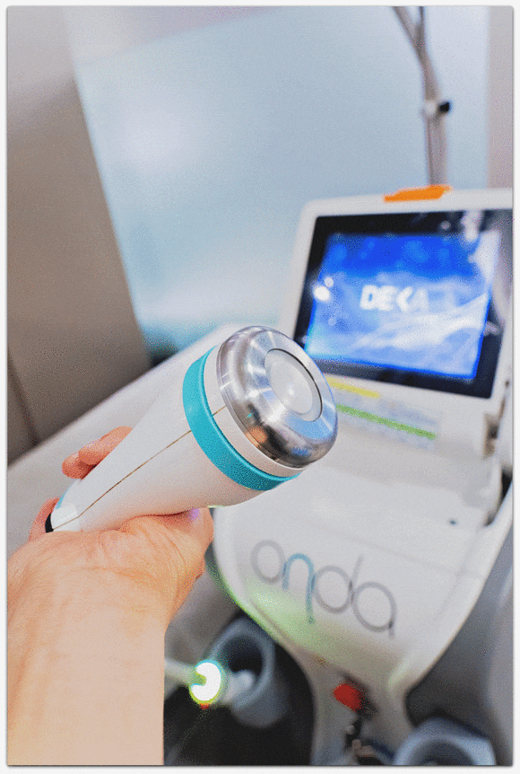 온다리프팅 6만줄 실제 효과, 통증, 부작용은 어떨까? 관련 이미지 7