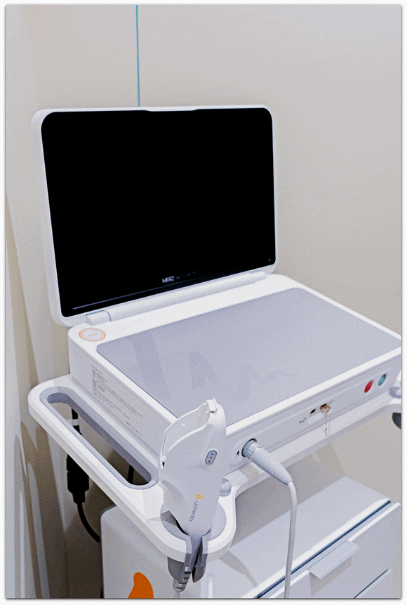 울타늄(울쎄라+티타늄) 효과, 왜 굳이 두 가지나 받을까? 관련 이미지 2