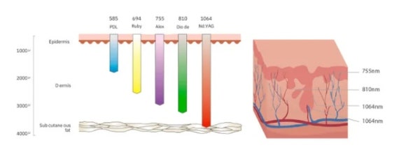온다 티타늄 같이 받았을 때 효과는? 관련 이미지 3