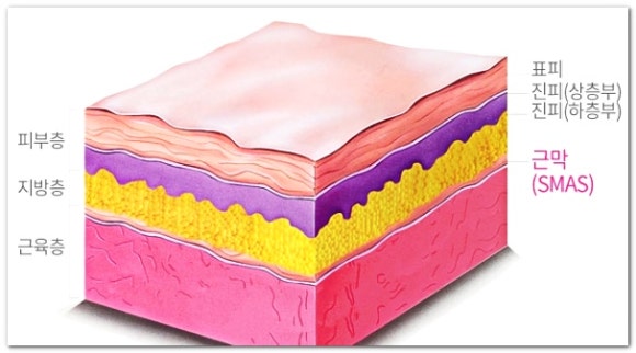 슈링크 볼뉴머 차이 비교, 효과는 각각 어떨까? 관련 이미지 2