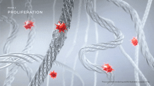 울쎄라 온다 리프팅 차이 비교, 같이 받으면 어떨까? 관련 이미지 3