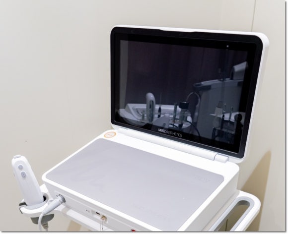 울쎄라피프라임 효과, 울쎄라랑 비교하면? 관련 이미지 1