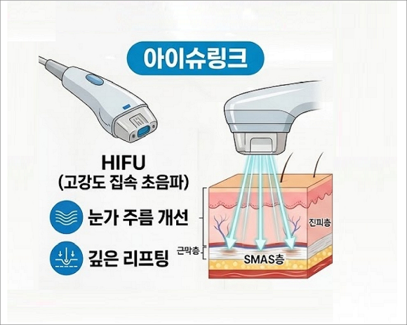 아이슈링크 vs. 아이올리지오 뭐가 좋을까 관련 이미지 2