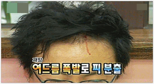 영등포여드름피부과 진료, 약 먹기 싫고 치료 통증 두렵다면? 관련 이미지 4