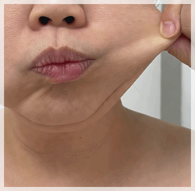 Dorim-dong Dermatology Clinic: Can I See Results Too? Check This First image 10