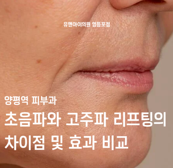 양평역 피부과, 초음파와 고주파 리프팅의 차이점 및 효과 비교 관련 이미지 1