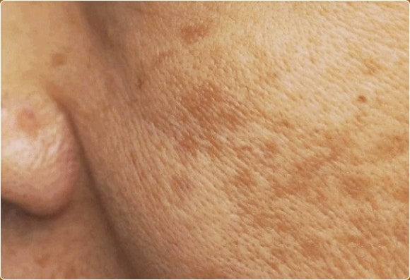 영등포루비레이저, 후기 궁금하다면? 관련 이미지 4