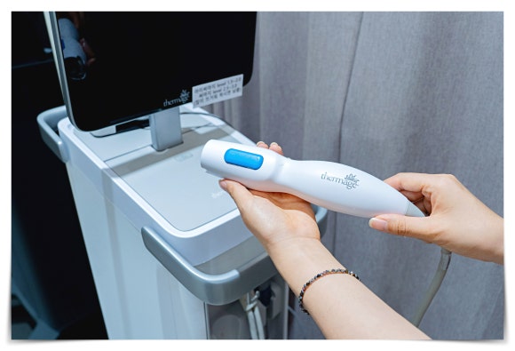 온다 써마지 리프팅 효과 한번에 정리해드립니다 관련 이미지 5