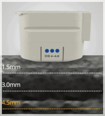 Dorim-dong Dermatology Clinic: Can I See Results Too? Check This First image 4