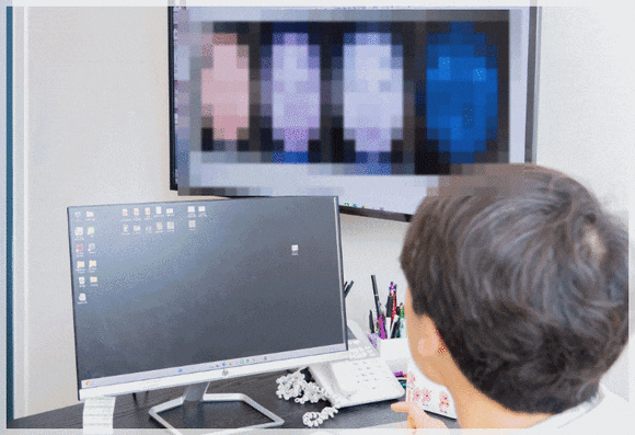 당산피부과, 울쎄라피프라임 시술 전 확인해 볼 2가지 관련 이미지 7