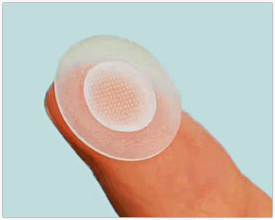 영등포 피부과 점빼기, 점 재발이 걱정된다면? 관련 이미지 10