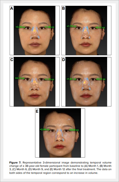 에버클 스킨부스터 효과, 어떻게 다를까? 관련 이미지 6