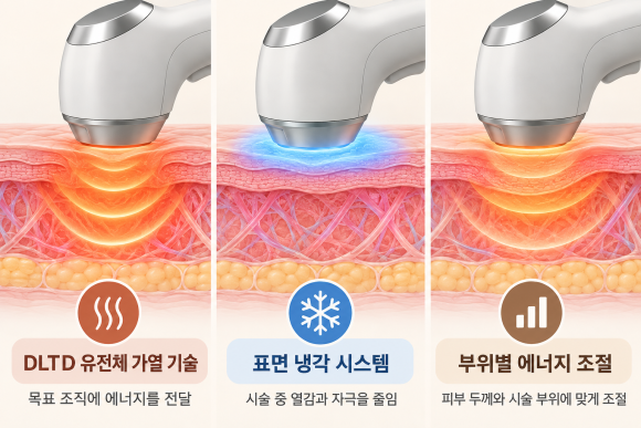 영등포올타이트, 받기 전에 이것만은 알고 가세요 관련 이미지 3