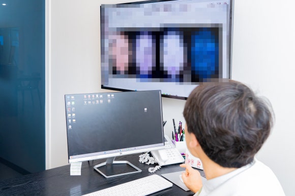 써마지 리쥬란 병행 효과와 주의할 점 정리 관련 이미지 8